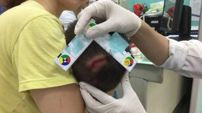 1歲童被自家土狗咬 頭頸多處撕裂傷住院觀察_新竹婚宴會館