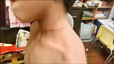 新竹風箏節 童遭風箏線割頸_桃園機場接送