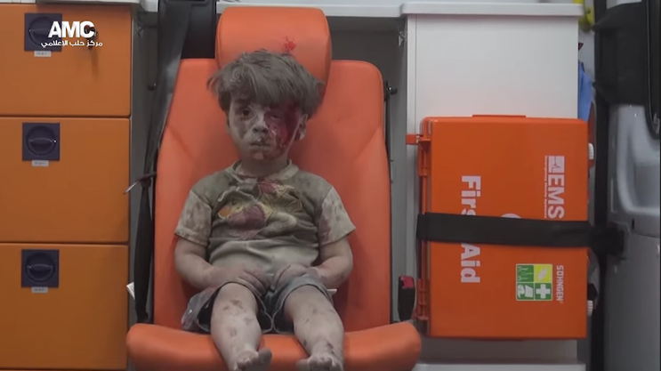 敘利亞童遭空襲炸傷 獲救後驚嚇模樣瘋傳_電腦割字
