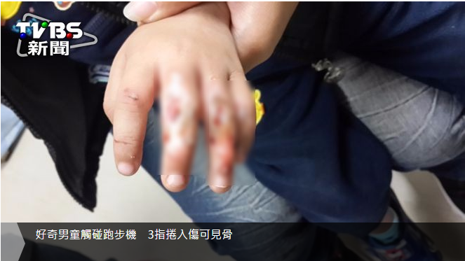 好奇男童觸碰跑步機 3指捲入傷可見骨_新竹婚宴會館