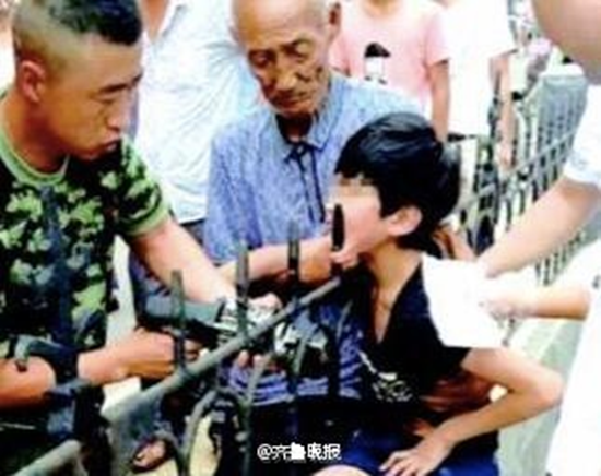 10歲男童社區玩耍跌倒　尖銳鐵欄杆「刺穿」他下巴！_新竹婚宴會館