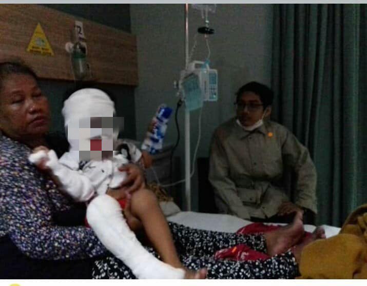 3歲男童玩「消毒液瓶」引大火上身 嚴重燒傷住院_電腦割字_電腦割字