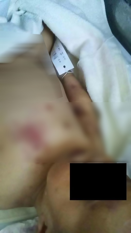 母偕姘頭打到脾臟斷裂！他怒PO女嬰遺體照_台東名產